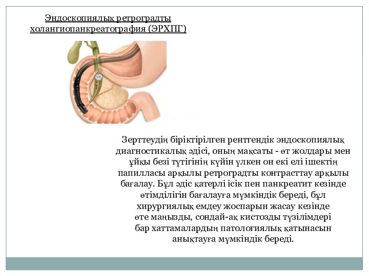 Эндоскопиялық ретроградты холангиопанкреатография (ЭРХПГ) Зерттеудің біріктірілген рентгендік эндоскопиялық диагностикалық әдісі, оның мақсаты