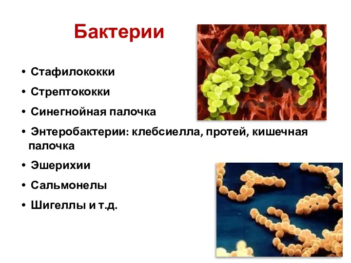 Бактерии Стафилококки Стрептококки Синегнойная палочка Энтеробактерии: клебсиелла, протей, кишечная палочка Эшерихии Сальмонелы Шигеллы и т.д.