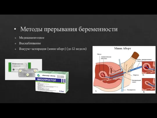 Методы прерывания беременности Медикаментозное Выскабливание Вакуум–аспирация (мини-аборт) (до 12 недели)