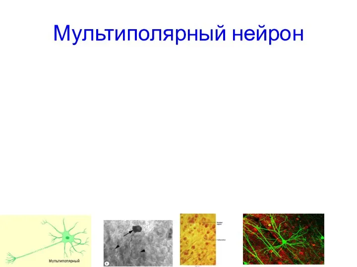 Мультиполярный нейрон