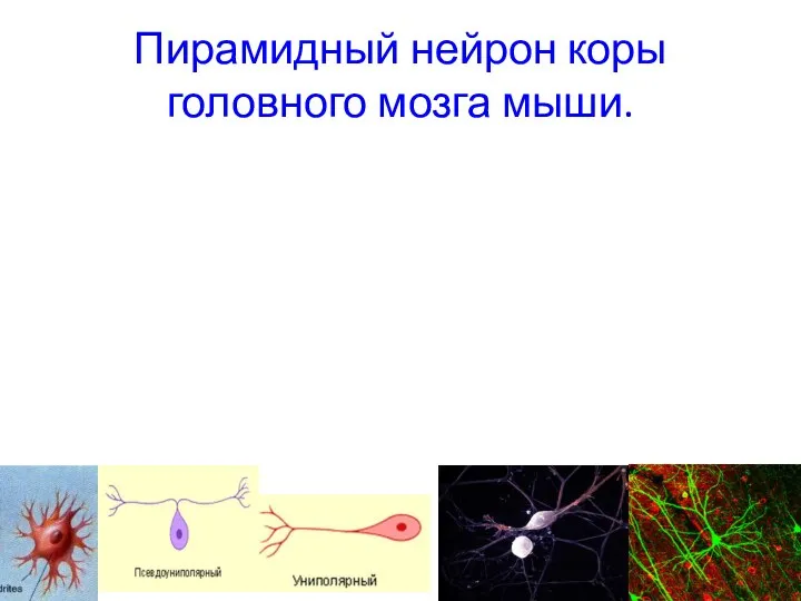 Пирамидный нейрон коры головного мозга мыши.