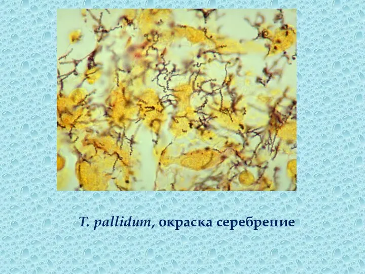 T. pallidum, окраска серебрение