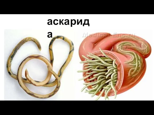 аскарида