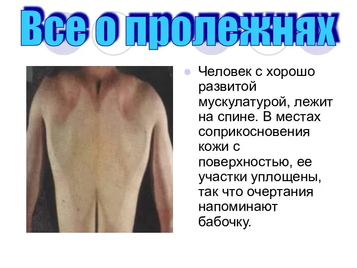 Человек с хорошо развитой мускулатурой, лежит на спине. В местах соприкосновения кожи