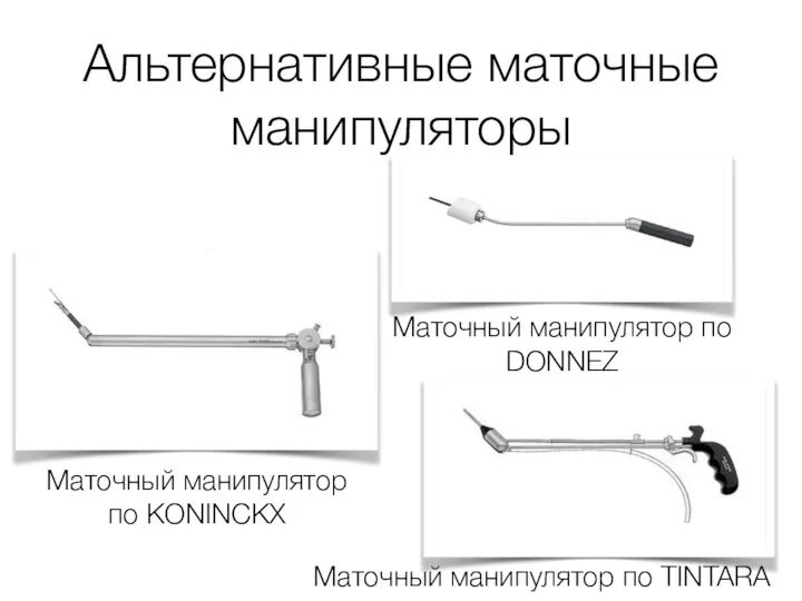 Альтернативные маточные манипуляторы Маточный манипулятор по KONINCKX Маточный манипулятор по DONNEZ Маточный манипулятор по TINTARA