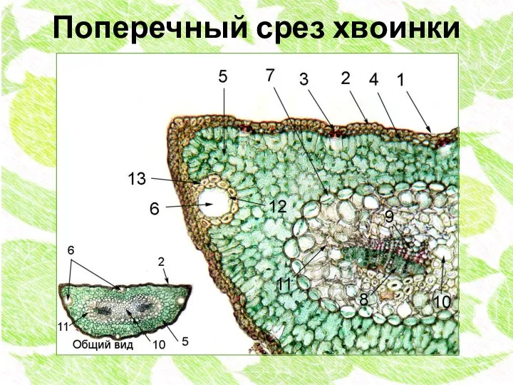 Поперечный срез хвоинки