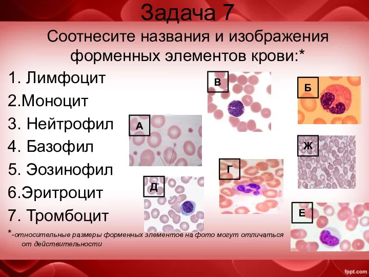 Задача 7 Соотнесите названия и изображения форменных элементов крови:* 1. Лимфоцит 2.Моноцит