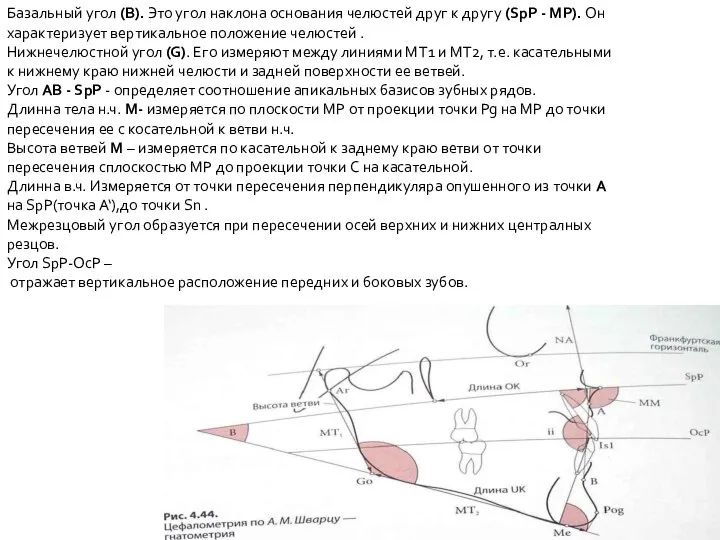 Базальный угол (В). Это угол наклона основания челюстей друг к другу (SpР