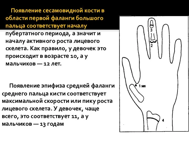 Появление сесамовидной кости в области первой фаланги большого пальца соответствует началу пубертатного