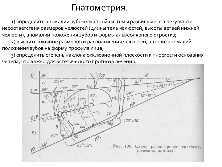 Гнатометрия. 1) определить аномалии зубочелюстной системы развившиеся в результате несоответствия размеров челюстей