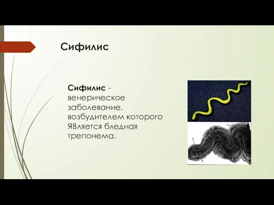 Сифилис Сифилис - венерическое заболевание, возбудителем которого ЯВляется бледная трепонема.