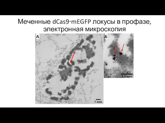 Меченные dCas9‑mEGFP локусы в профазе, электронная микроскопия