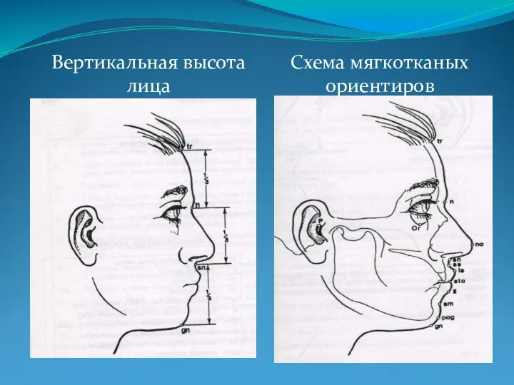 Схема мягкотканых ориентиров Вертикальная высота лица