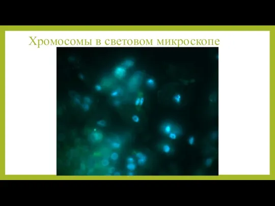 Хромосомы в световом микроскопе