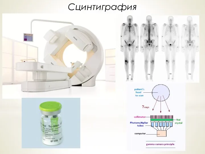 Сцинтиграфия