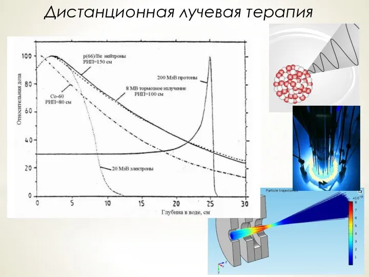 Дистанционная лучевая терапия