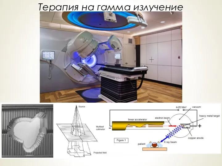 Терапия на гамма излучение