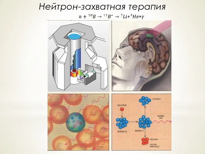 Нейтрон-захватная терапия