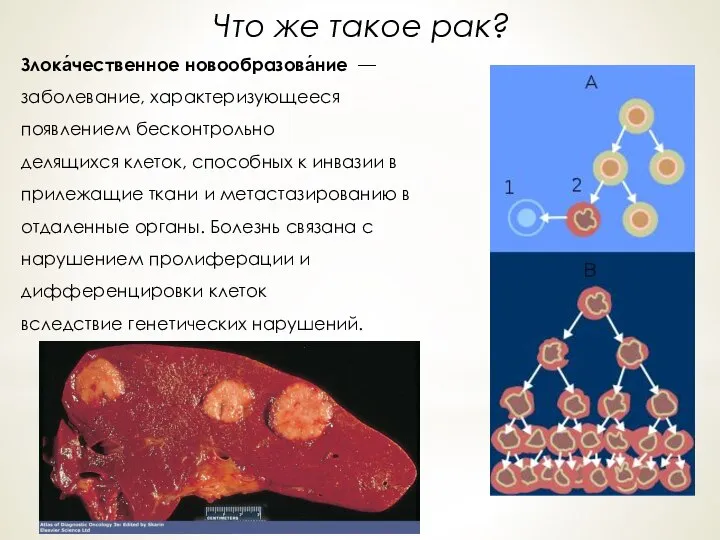 Что же такое рак? Злока́чественное новообразова́ние — заболевание, характеризующееся появлением бесконтрольно делящихся