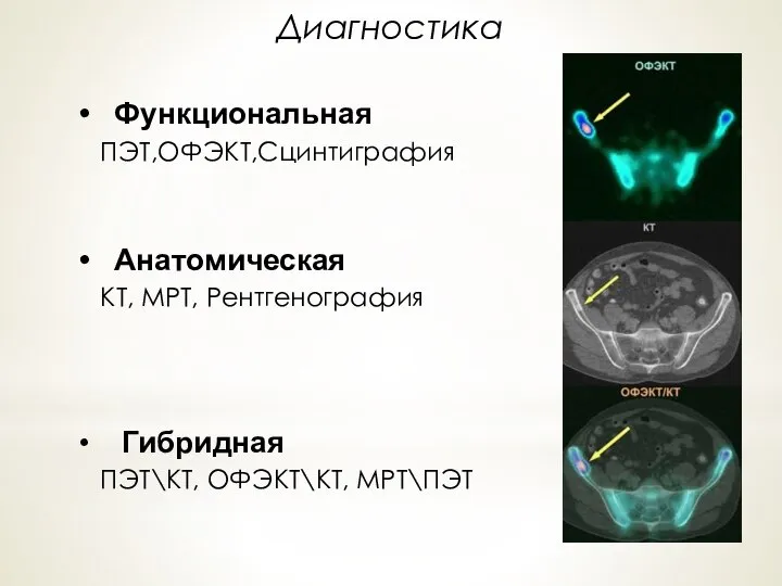 Диагностика Функциональная ПЭТ,ОФЭКТ,Сцинтиграфия Анатомическая КТ, МРТ, Рентгенография Гибридная ПЭТ\КТ, ОФЭКТ\КТ, МРТ\ПЭТ