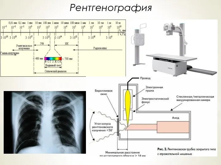 Рентгенография