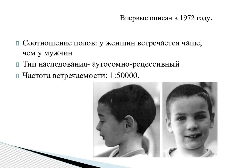 Соотношение полов: у женщин встречается чаще, чем у мужчин Тип наследования- аутосомно-рецессивный