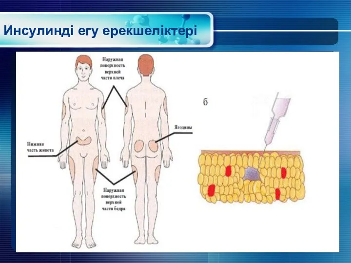 Инсулинді егу ерекшеліктері