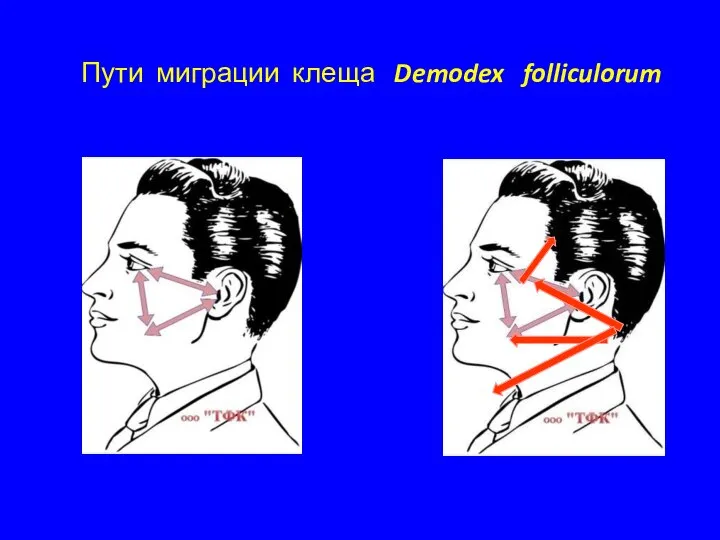 Пути миграции клеща Demodex folliculorum