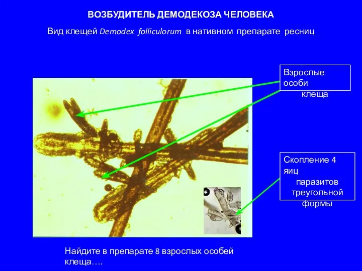 ВОЗБУДИТЕЛЬ ДЕМОДЕКОЗА ЧЕЛОВЕКА Вид клещей Demodex folliculorum в нативном препарате ресниц Найдите