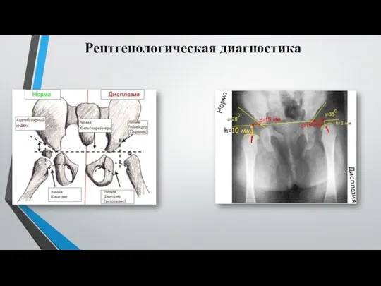 Рентгенологическая диагностика