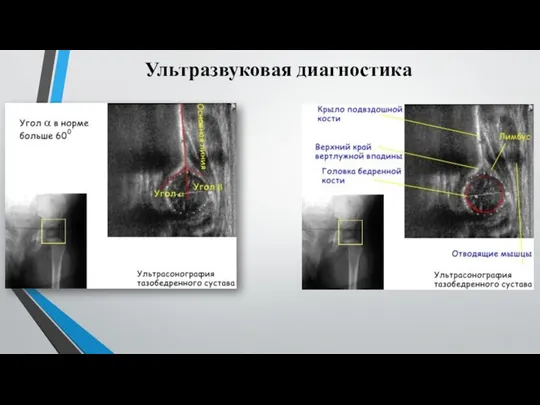 Ультразвуковая диагностика