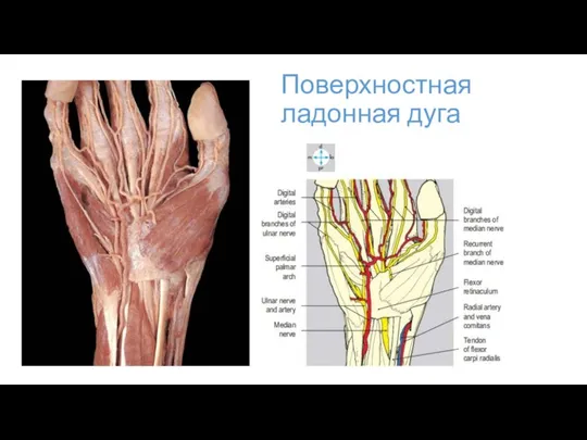 Поверхностная ладонная дуга