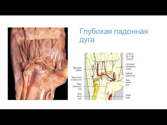 Глубокая ладонная дуга