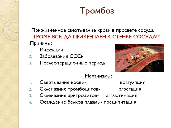 Тромбоз Прижизненное свертывание крови в просвете сосуда. ТРОМБ ВСЕГДА ПРИКРЕПЛЕН К СТЕНКЕ