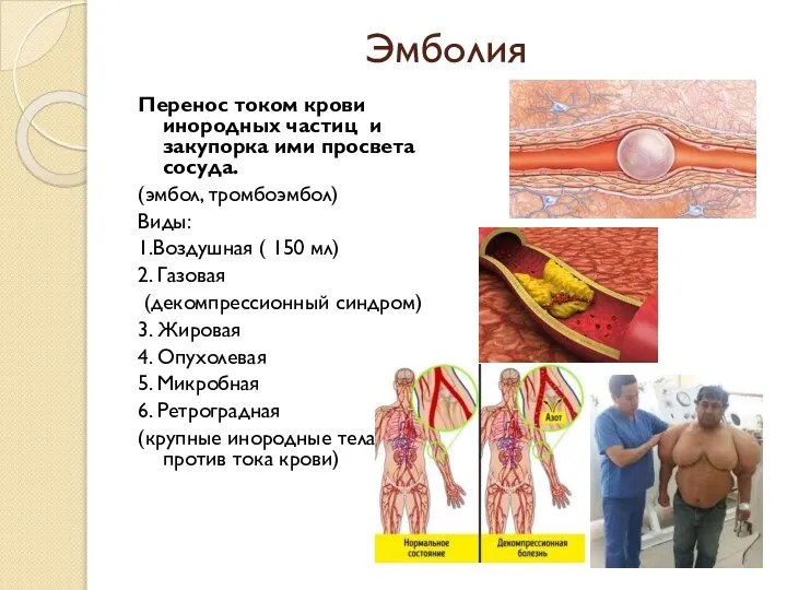 Эмболия Перенос током крови инородных частиц и закупорка ими просвета сосуда. (эмбол,