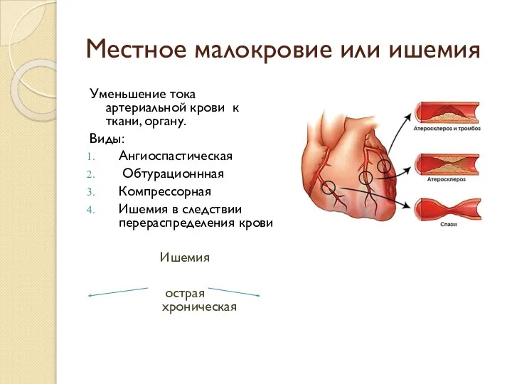 Местное малокровие или ишемия Уменьшение тока артериальной крови к ткани, органу. Виды: