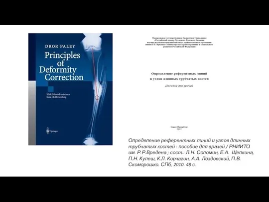 Определение референтных линий и углов длинных трубчатых костей : пособие для врачей