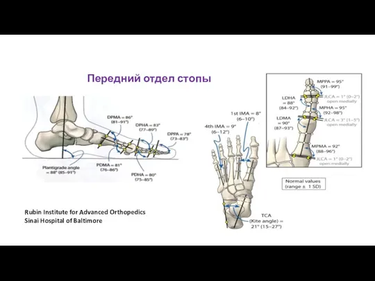 Rubin Institute for Advanced Orthopedics Sinai Hospital of Baltimore Передний отдел стопы