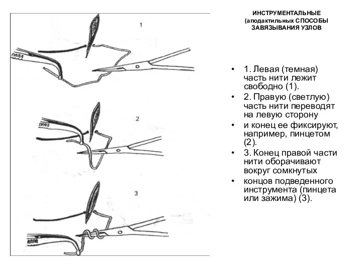 ИНСТРУМЕНТАЛЬНЫЕ (аподактильных СПОСОБЫ ЗАВЯЗЫВАНИЯ УЗЛОВ 1. Левая (темная) часть нити лежит свободно