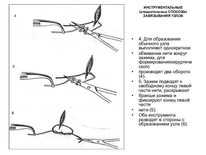 ИНСТРУМЕНТАЛЬНЫЕ (аподактильных СПОСОБЫ ЗАВЯЗЫВАНИЯ УЗЛОВ 4. Для образования обычного узла выполняют однократное