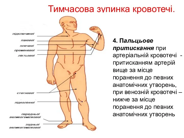 Тимчасова зупинка кровотечі. 4. Пальцьове притискання при артеріальній кровотечі - притисканням артерій