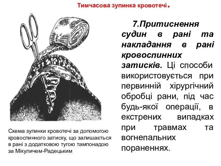 Тимчасова зупинка кровотечі. 7.Притиснення судин в рані та накладання в рані кровоспинних