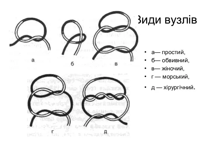 Види вузлів а— простий, б— обвивний, в— жіночий, г — морський, д — хірургічний.