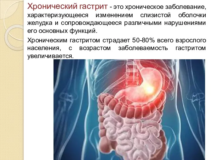 Хронический гастрит - это хроническое заболевание, характеризующееся изменением слизистой оболочки желудка и