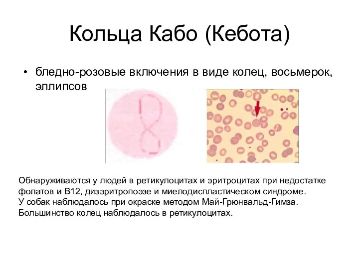 Кольца Кабо (Кебота) бледно-розовые включения в виде колец, восьмерок, эллипсов Обнаруживаются у