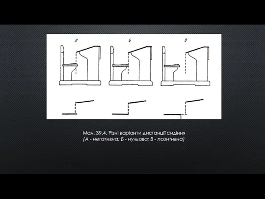 Мал. 39.4. Різні варіанти дистанції сидіння (А - негативна; Б - нульова; В - позитивна)