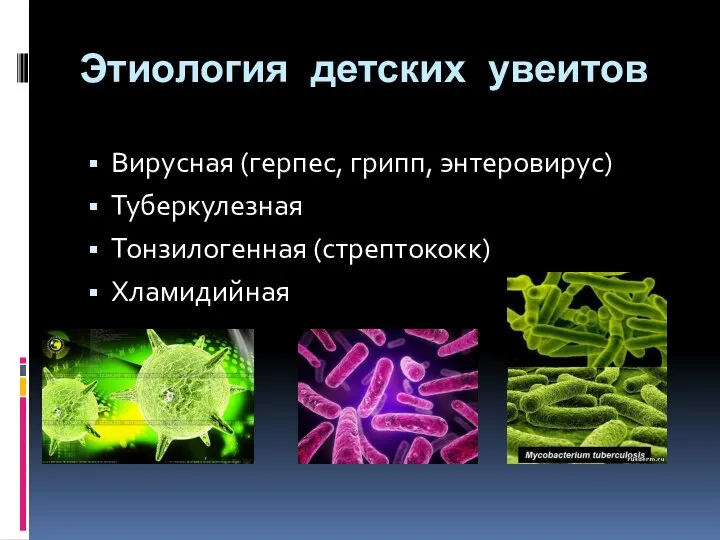 Этиология детских увеитов Вирусная (герпес, грипп, энтеровирус) Туберкулезная Тонзилогенная (стрептококк) Хламидийная