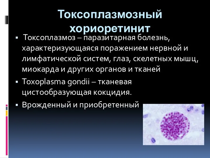Токсоплазмозный хориоретинит Токсоплазмоз – паразитарная болезнь, характеризующаяся поражением нервной и лимфатической систем,