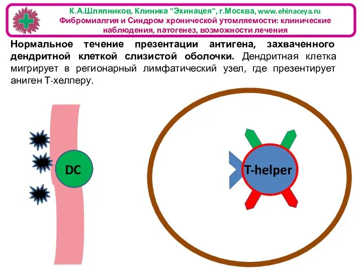 К.А.Шляпников, Клиника "Эхинацея", г.Москва, www.ehinaceya.ru Фибромиалгия и Синдром хронической утомляемости: клинические наблюдения,