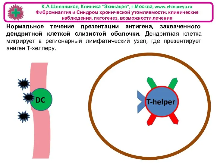 К.А.Шляпников, Клиника "Эхинацея", г.Москва, www.ehinaceya.ru Фибромиалгия и Синдром хронической утомляемости: клинические наблюдения,